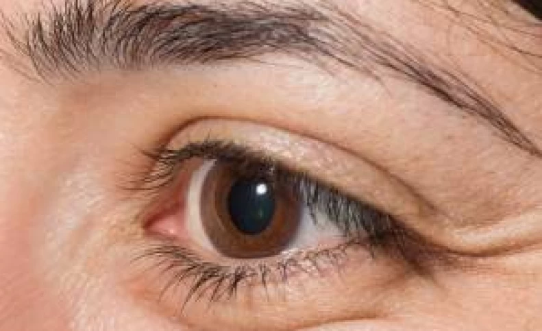 پف چشم های من از چیه ؟