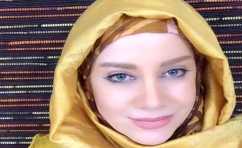 چهره شراره رخام پس از تخلیه ژل لب هایش + تصاویر