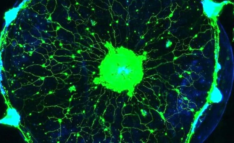 خواندن ذهن یک عروس دریایی توسط محققان "کلتک" آمریکا