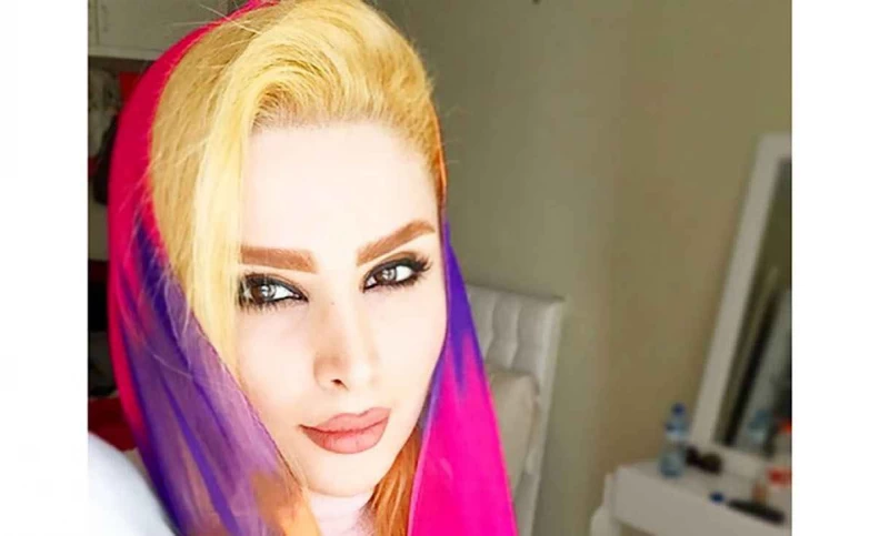 نشانه جالب روی صورت بچه دنیا جهانبخت ! + تصاویری بانمک