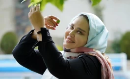 جراحی زیبایی که بین بازیگران ایرانی خیلی مٌد شده